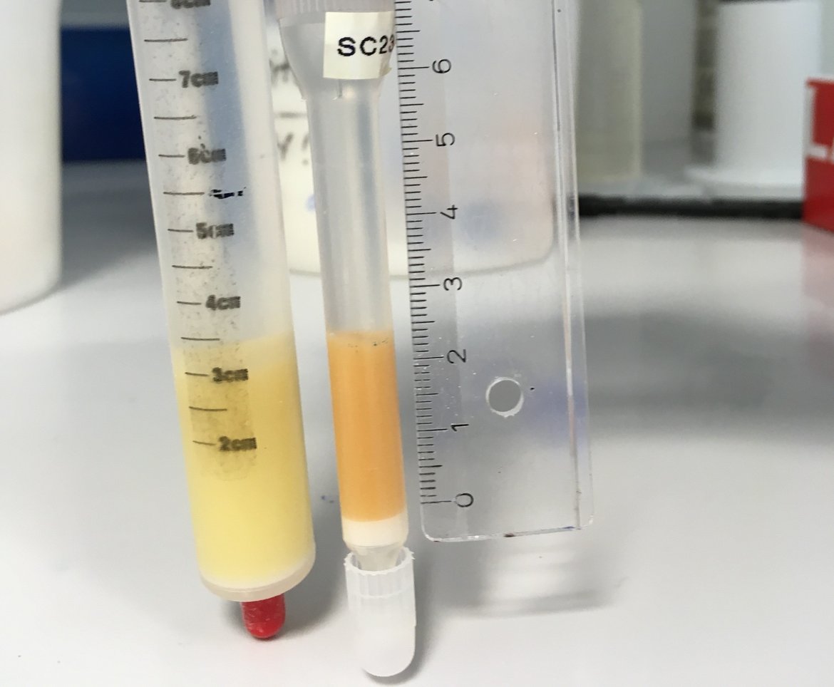 Fig 3. Filled Be-columns. (Photo: H. Wittmann-Oelze)